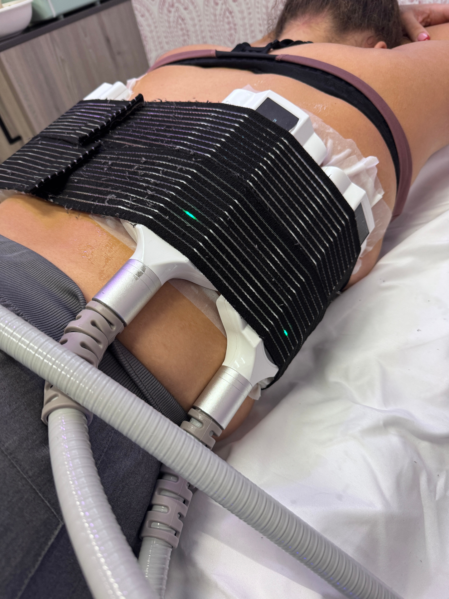 CryoLipo applicator and EMS pads in a session